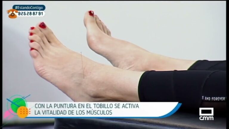Alivio de Contracturas: Beneficios de la Acupuntura