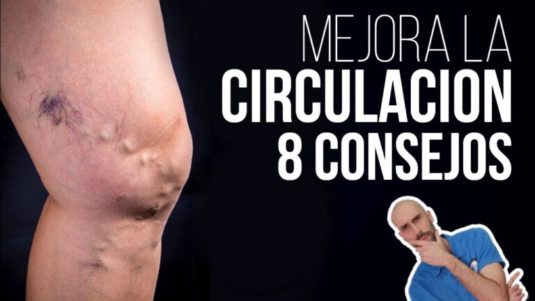 Prevenci&oacute;n de Varices a Trav&eacute;s de H&aacute;bitos Saludables