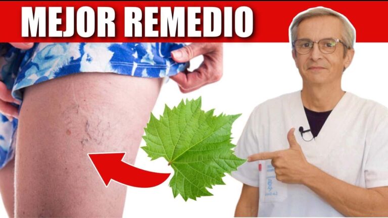 Medicamentos Recetados Eficaces para Tratar las Varices
